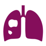 Ícono tumor en el pulmón